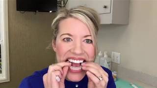 Teeth Whitening Instructions [upl. by Hardigg661]