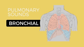 Bronchial Breath Sounds  Lung Sounds  Medzcool [upl. by Dearman]