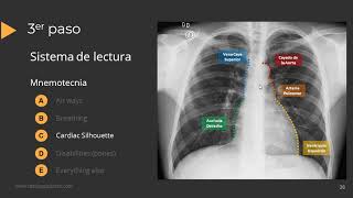 Tutorial Radiografía de Torax [upl. by Perr280]