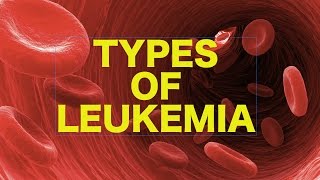 Leukemia  USMLE [upl. by Terbecki374]