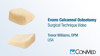 Dr Trevor Williams  Evans Calcaneal Osteotomy  CONMED Surgical Technique [upl. by Alletnahs319]