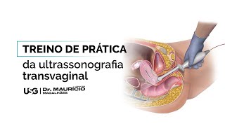 Treino de prática da ultrassonografia Transvaginal [upl. by Jerrol82]