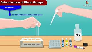 Determination of blood groups animation  Physiology practicals [upl. by Saideman309]