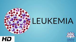 LEUKEMIA Causes Signs and Symptoms Diagnosis and Treatment [upl. by Alyakam]