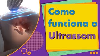 Como funciona o ultrassom [upl. by Suivatco685]