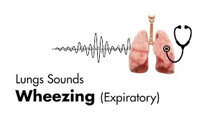 What bronchitis sounds like [upl. by Holey]