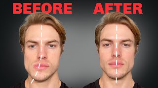 How to Fix Asymmetrical Jaw amp Face FOREVER [upl. by Aubree]