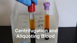 Centrifugation and Aliquoting of Blood Serum and Plasma [upl. by Dubois]