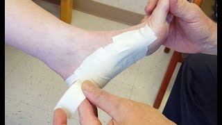 LowDye Strapping for Plantar Fasciitis [upl. by Debby]