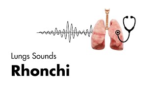 Emphysema vs Bronchitis [upl. by Anelat]