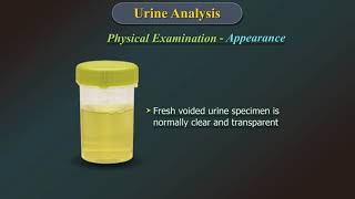 Urine Analysis [upl. by Ardis998]