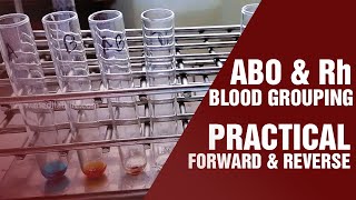 Blood Grouping Test  Principle and procedure  Cell Grouping  Serum Grouping [upl. by Betteanne]