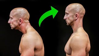 Fix Your Posture In Just 5 Minutes [upl. by Greenman926]