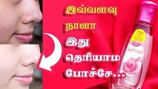 Benefits Of Rose Water For Skin  Tamil Beauty Tv [upl. by Violetta12]