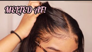 How to RE Install Frontal Wigs for Beginners  VERY DETAILED  Melt Transparent Lace [upl. by Emaj543]