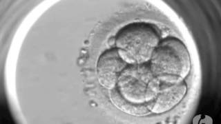 Evolução dos embriões no Laboratório de Reprodução Humanawmv [upl. by Atiragram]