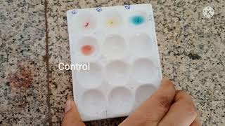 Blood group determination physiology practical [upl. by Oisacin]